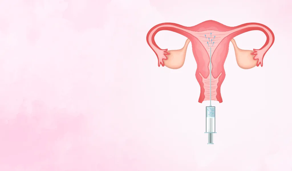 illustration of a uterus with a syringe, representing intrauterine insemination procedure