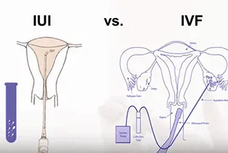 Comparison of IUI and IVF treatments with diagrams of reproductive anatomy.